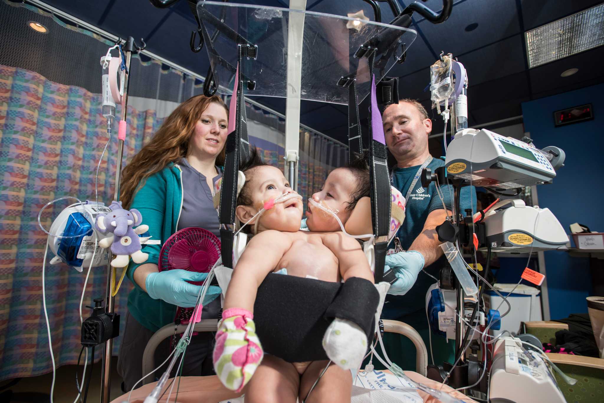 Doctors prepare for complex procedure to separate conjoined twins