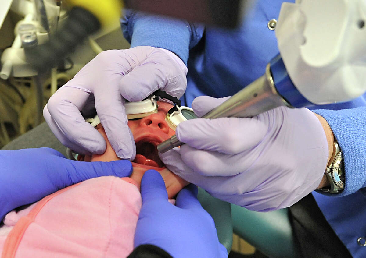 'Tiedtongue' impedes breastfeeding by some babies