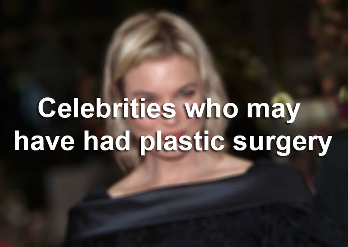These stars are rumored to have gone under the knife. See for yourself.