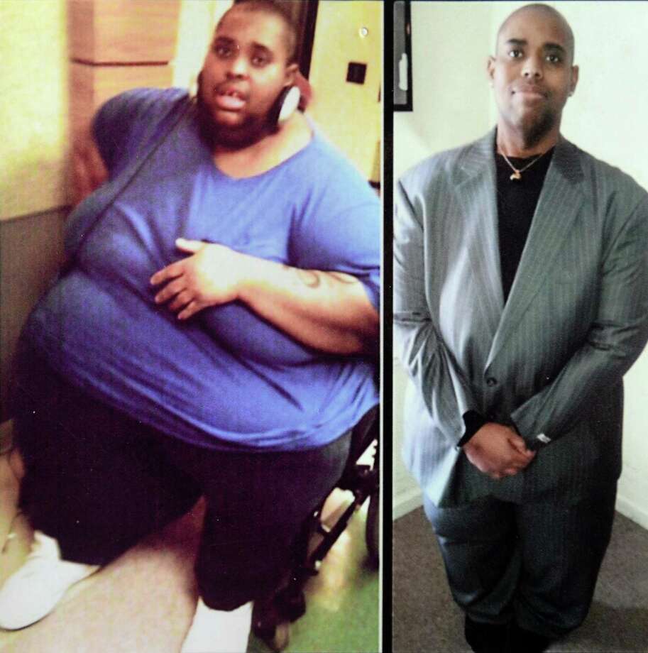 One man's journey from 940 pounds to 305 Times Union