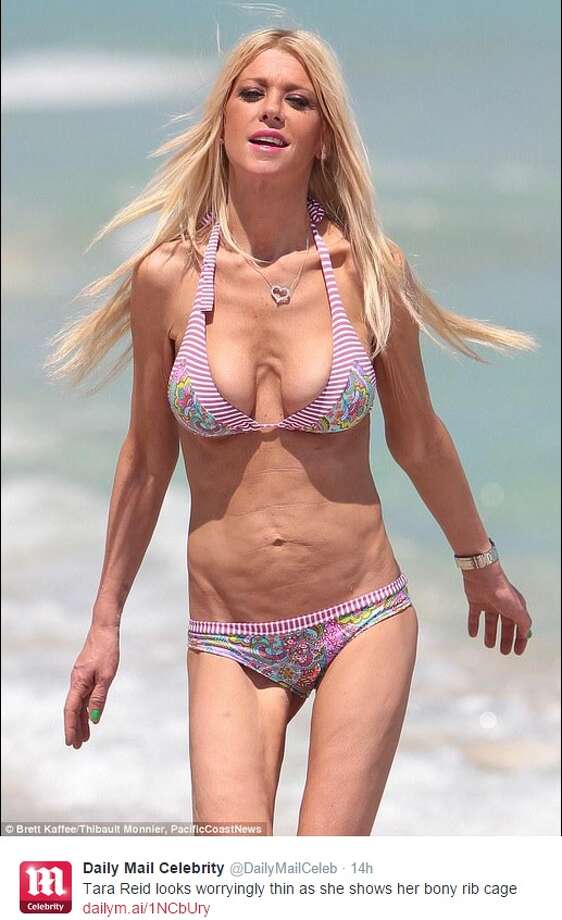 Tara Reid Bikini Photos Cause Alarm Online After Procedure Left Her