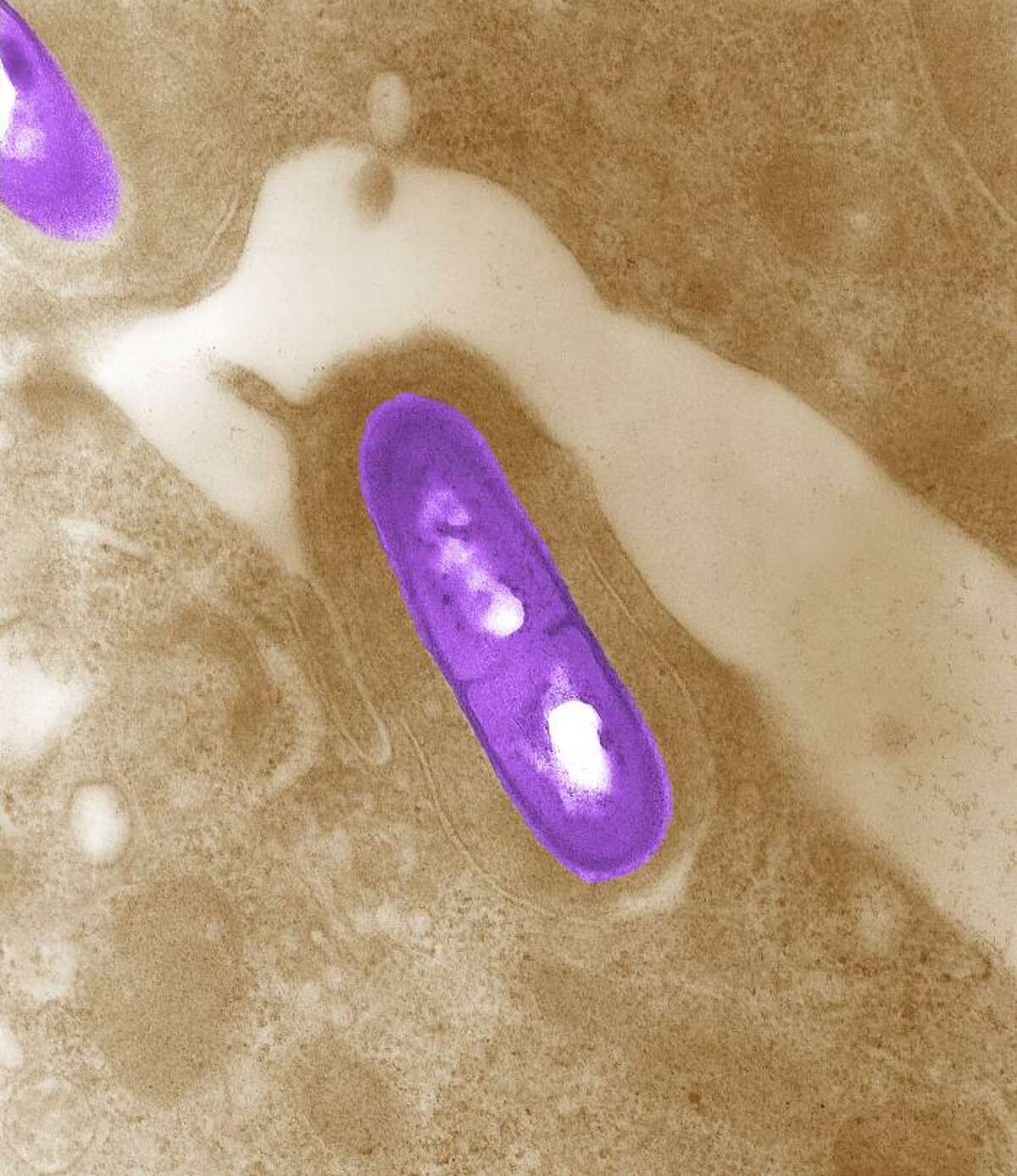 Listeria rare, but potentially serious