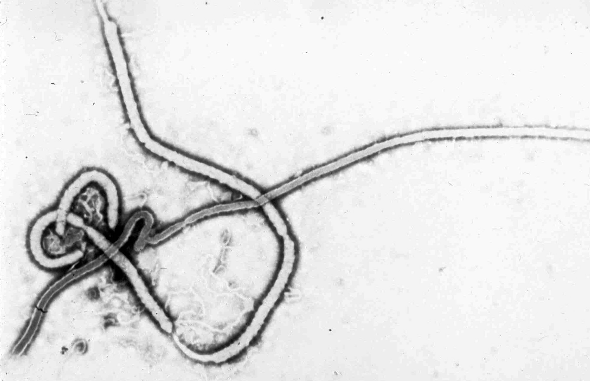 Ebola Case Suggests Sex Unsafe Indefinitely