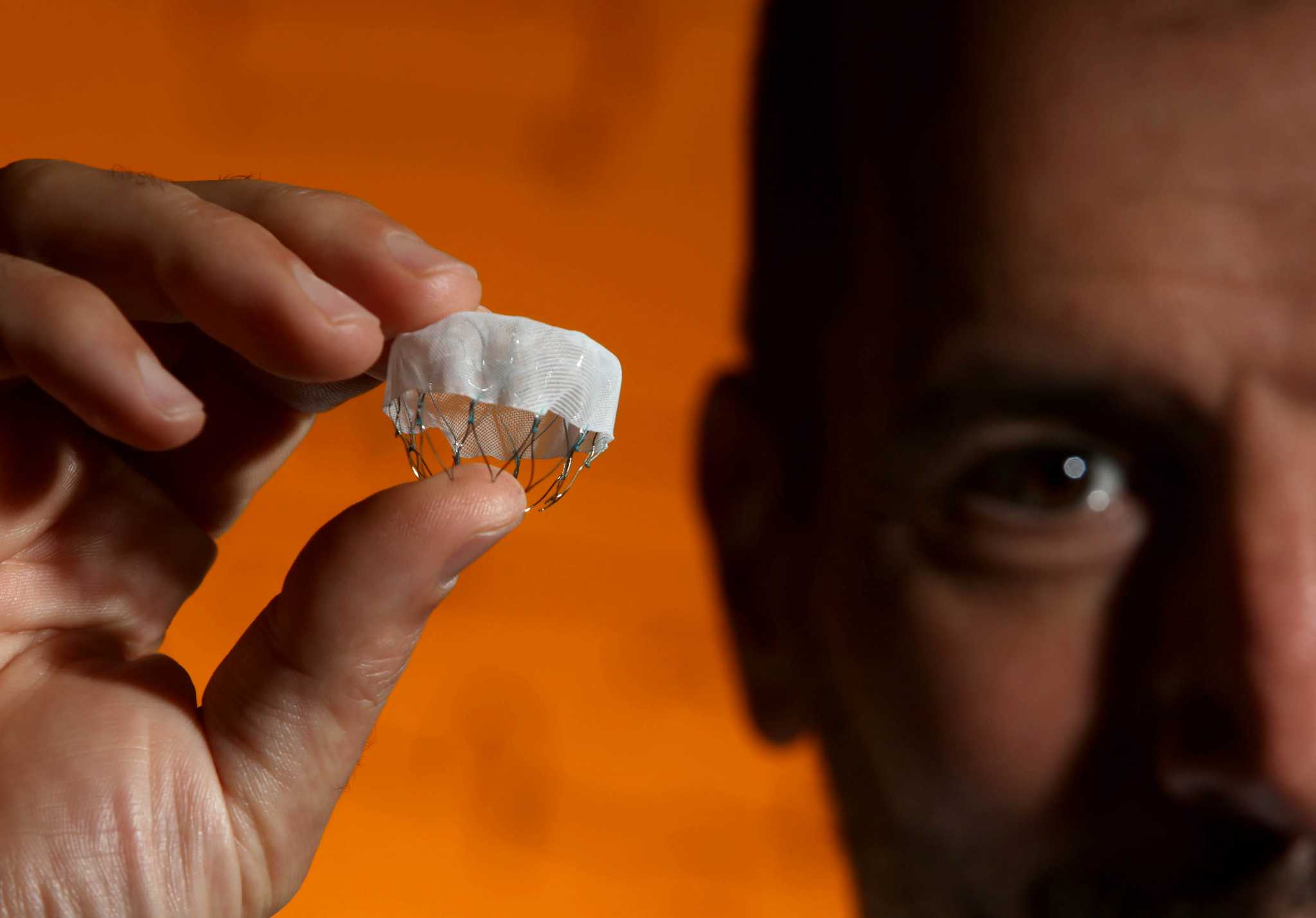 New device effective in preventing blood clots, but experts fear