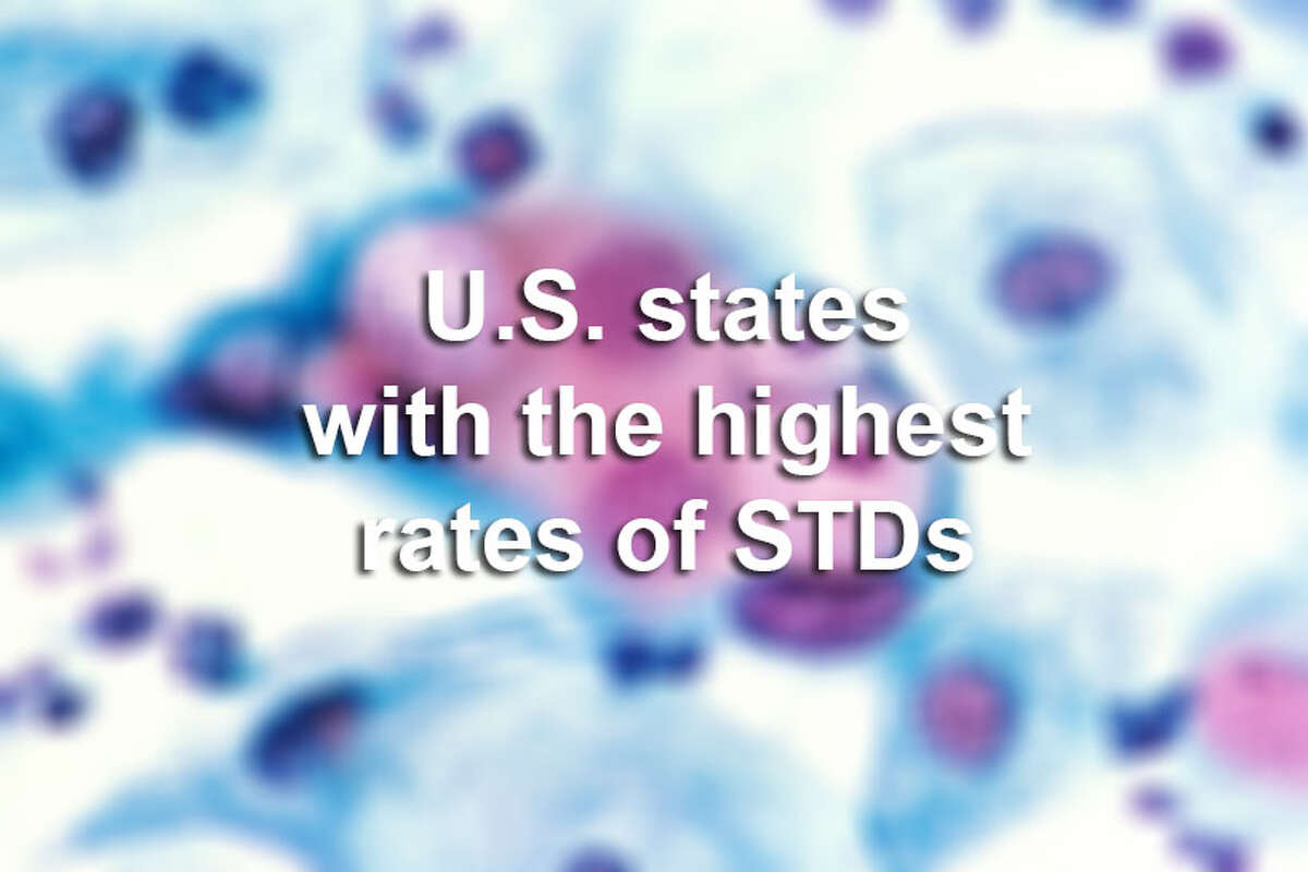 Click through the slideshow to see a list of the U.S. states with the highest rates of STDs.