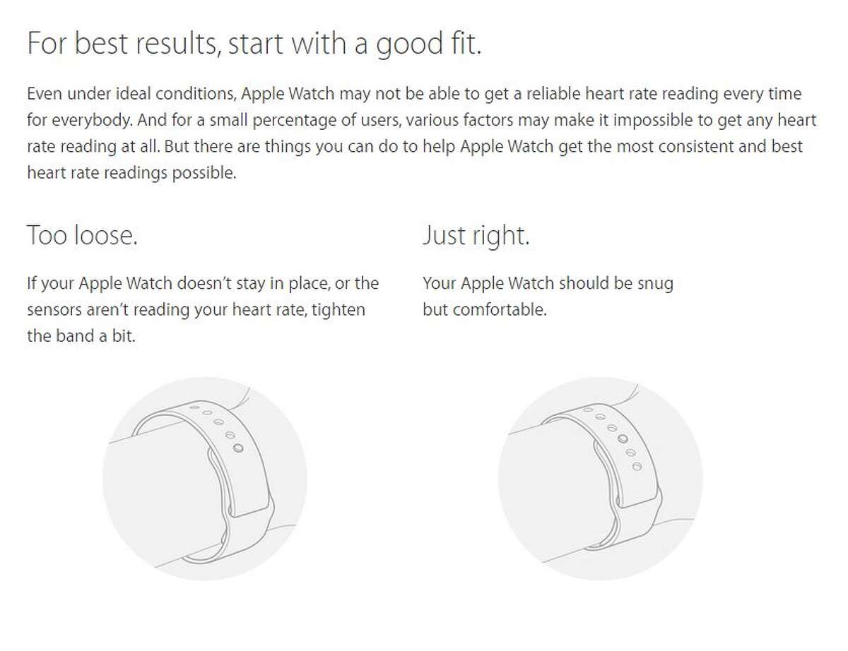 What's wrong with the Apple Watch?