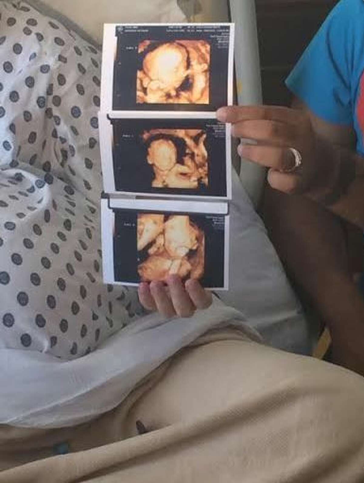The Torres triplets in their first photos. 