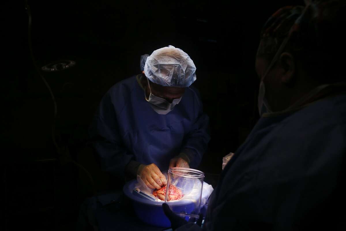 Dr. Andrew Posselt works over the kidney of altruistic donor Reid Moran-Haywood at UCSF Medical Center at Parnassus after removing it during surgery and before it is transported to California Pacific Medical Center to be transplanted on Thursday, June 4, 2015 in San Francisco, Calif. On June 4 and 5th, the surgeries for a 9-way kidney transplant chain are talking place at UCSF Medical Center and California Pacific Medical Center.