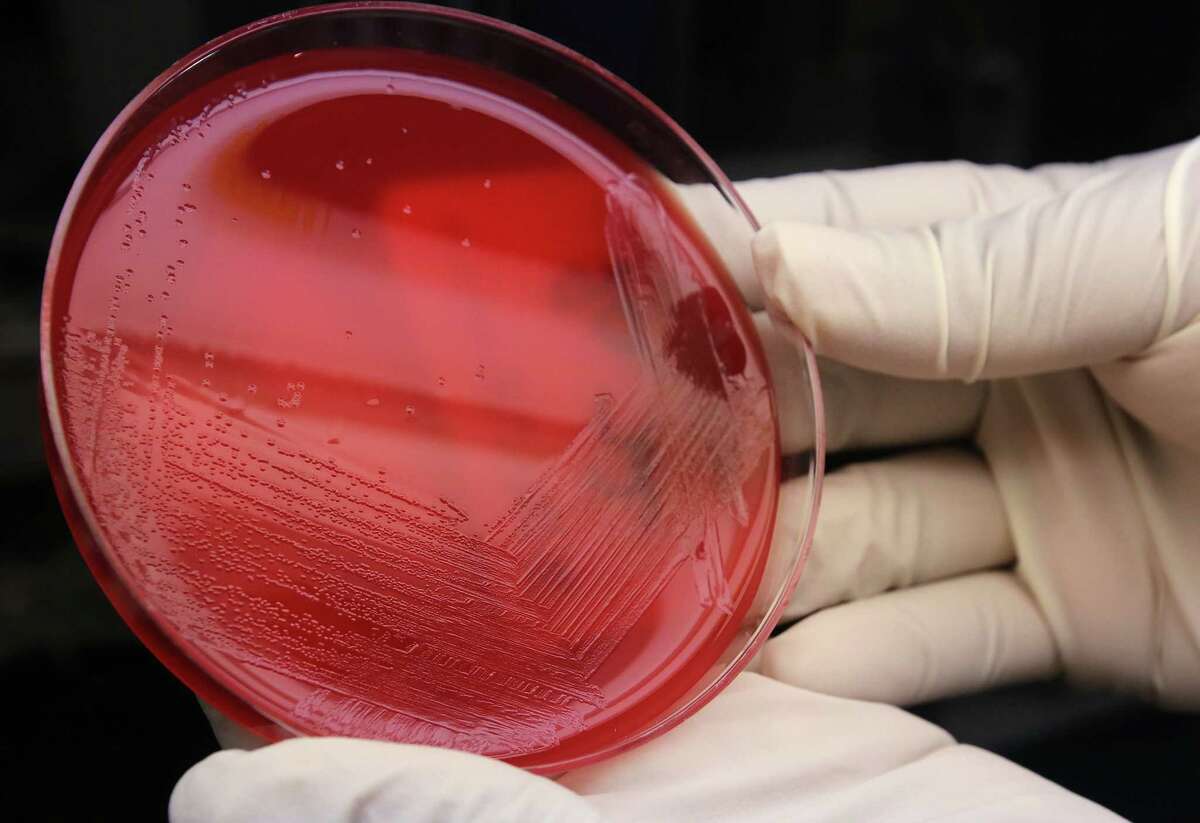 An agar plate with listeria cultures ready for testing in the Medical Microbiology lab at the Houston Health and Human Services Department on Thursday, June 18, 2015, in Houston. ( Mayra Beltran / Houston Chronicle )