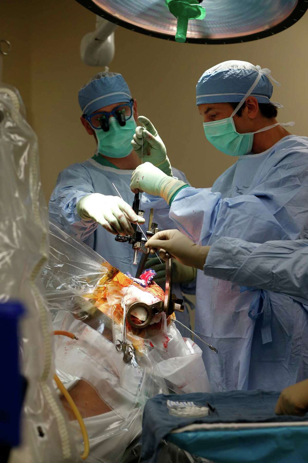 Doctors try deep brain stimulation to treat chronic depression