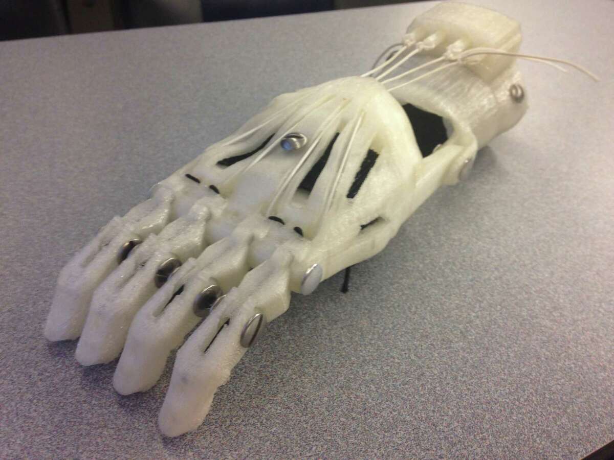 Big Idea: Cheap 3D-printed Prosthetics For Kids