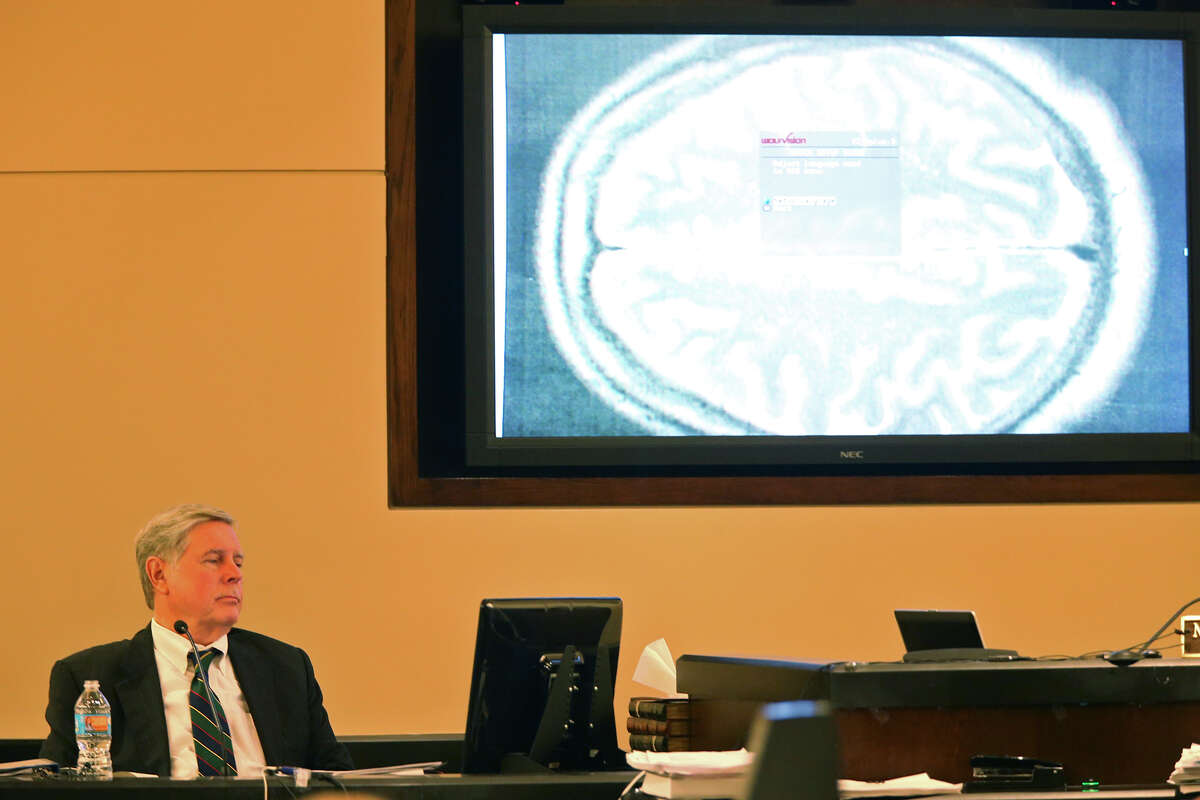 Defense witness, James Merikangas, a neurologist and psychiatrist, testifies in the capital murder trial of Mark Anthony Gonzalez in the Bexar County 175th District Court, Tuesday, Oct. 6, 2015. Gonzalez is accused of killing Bexar County Sheriff's Sgt. Kenneth Vann in May of 2011. The trial is in its third week.
