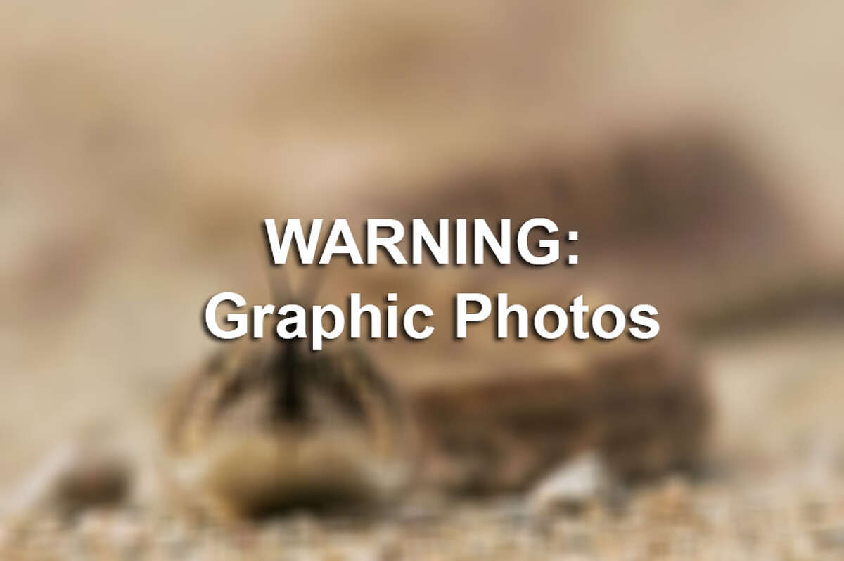 Texas country music star, Kevin Fowler, is taking to Facebook to warn against the feared enemy of rural area areas by posting photos of a gnarly rattlesnake bite.