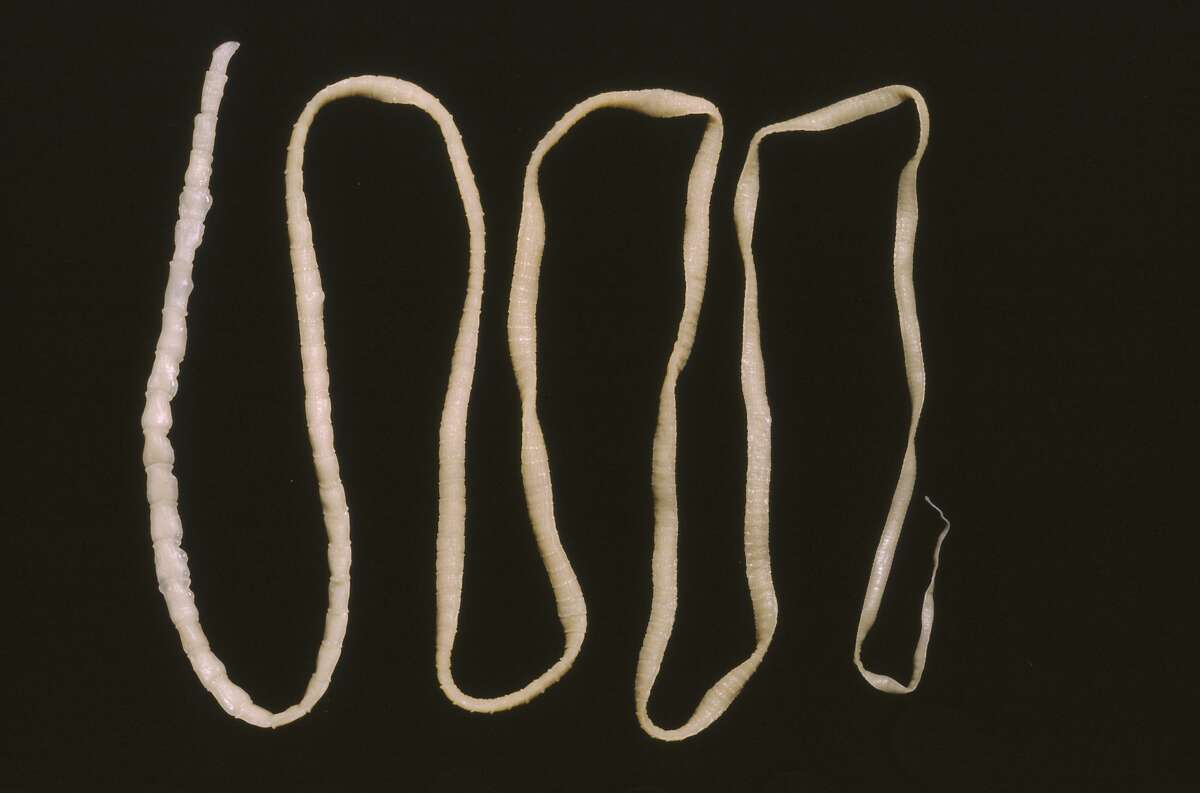 Man Gets Fatal Cancer From His Own Tapeworm 