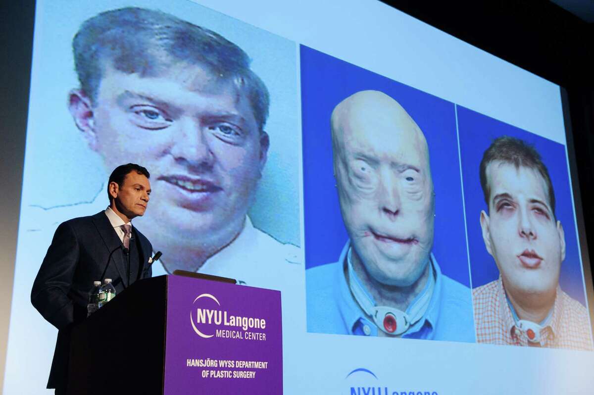 Dr. Eduardo Rodriguez talks about the successful completion of the most extensive face transplant to date at New York University’s Langone Medical Center in New York. The procedure in August transferred the face of David Rodebaugh to Patrick Hardison.