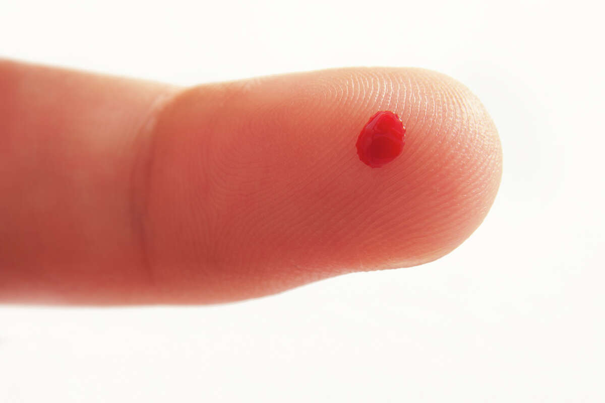 Researchers at Rice University found that the contents of blood can vary significantly from drop to drop.