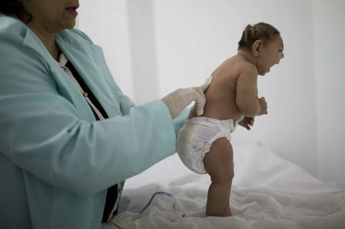 Lara, who is less then three months old and was born with microcephaly, is examined by a neurologist at the Pedro I hospital in Campina Grande, Paraiba state, Brazil, Friday, Feb. 12, 2016. Many researchers believe the Zika virus can cause microcephaly in the fetuses of pregnant women.