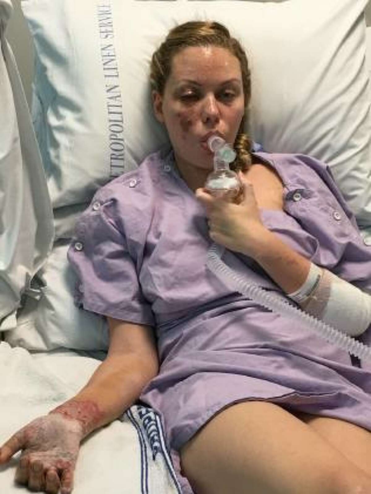 Felicia Djamirze, beauty queen and former Miss Australia, claims she could lose vision in her right eye after police detonated a flash bomb in her home on Feb. 9, which exploded in her face.