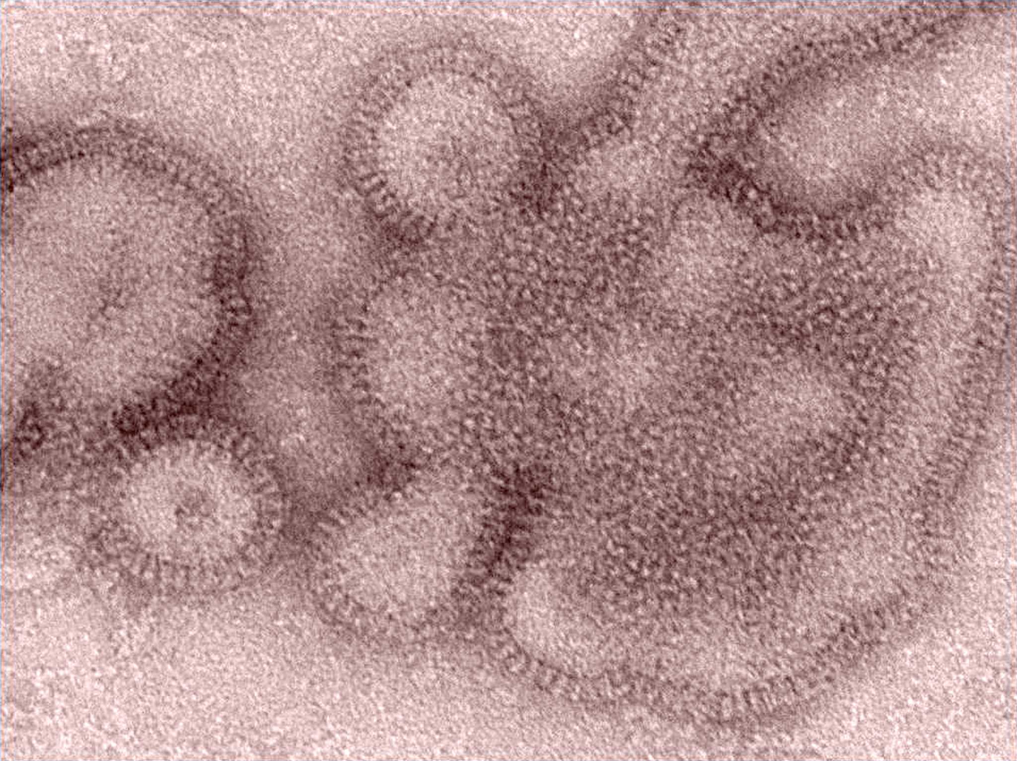 Flu on upswing statewide, Greenwich flue season mild so far