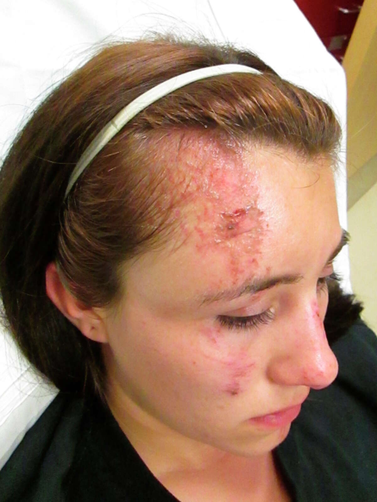 Gabrielle Lemos sued after suffering injuries she claims were inflicted by a deputy.