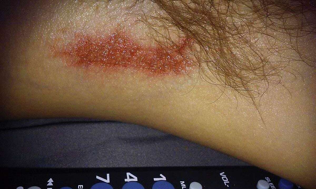 Classaction lawsuit claims Old Spice deodorant causes 'chemical burns