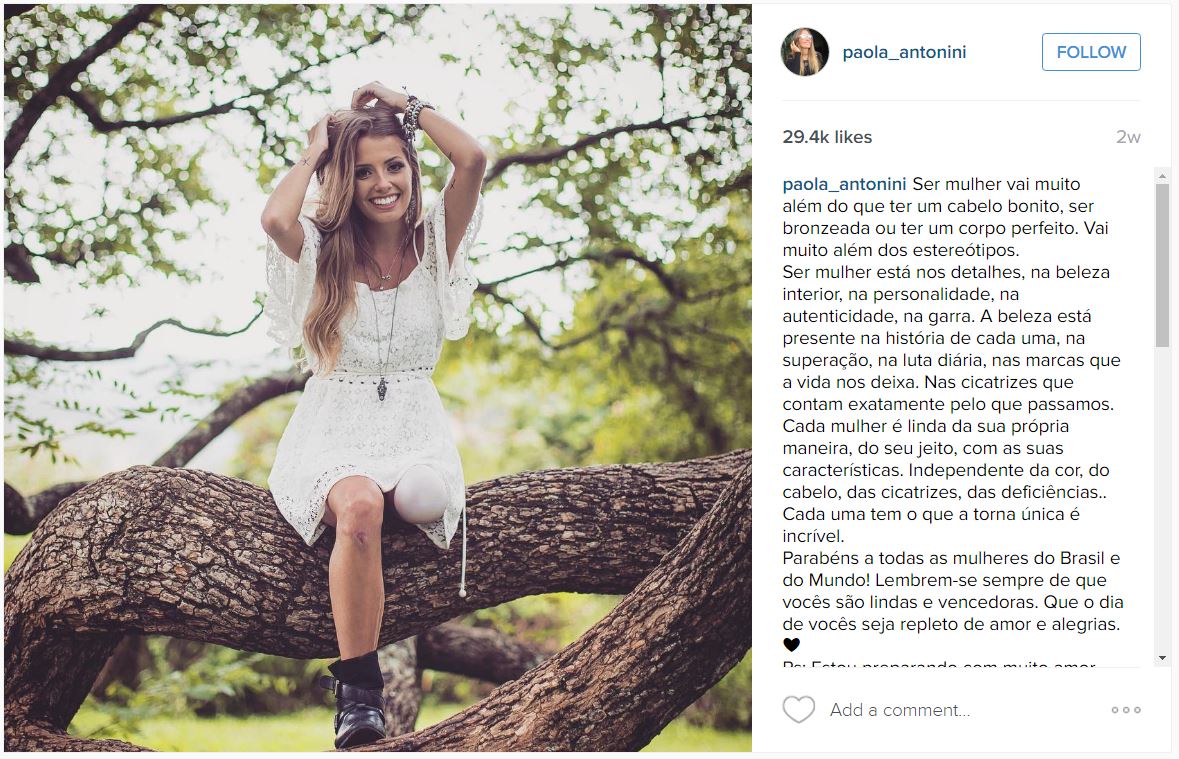 Meet Paola Antonini, an Amputee Model Who Treats Her Prosthetic Leg as a  Beautiful Accessory / Bright Side