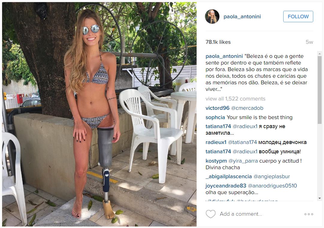 Amputee model Paola Antonini posts bikini photos to show off her