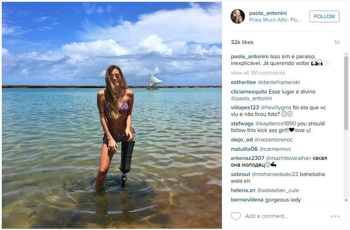 Brazilian model Paola Antonini is inspiring others by sharing photos of herself following the loss of her left leg in a car crash.