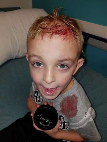 5 Year Old San Antonio Rampage Fan Hit By Puck In Head Rushed To