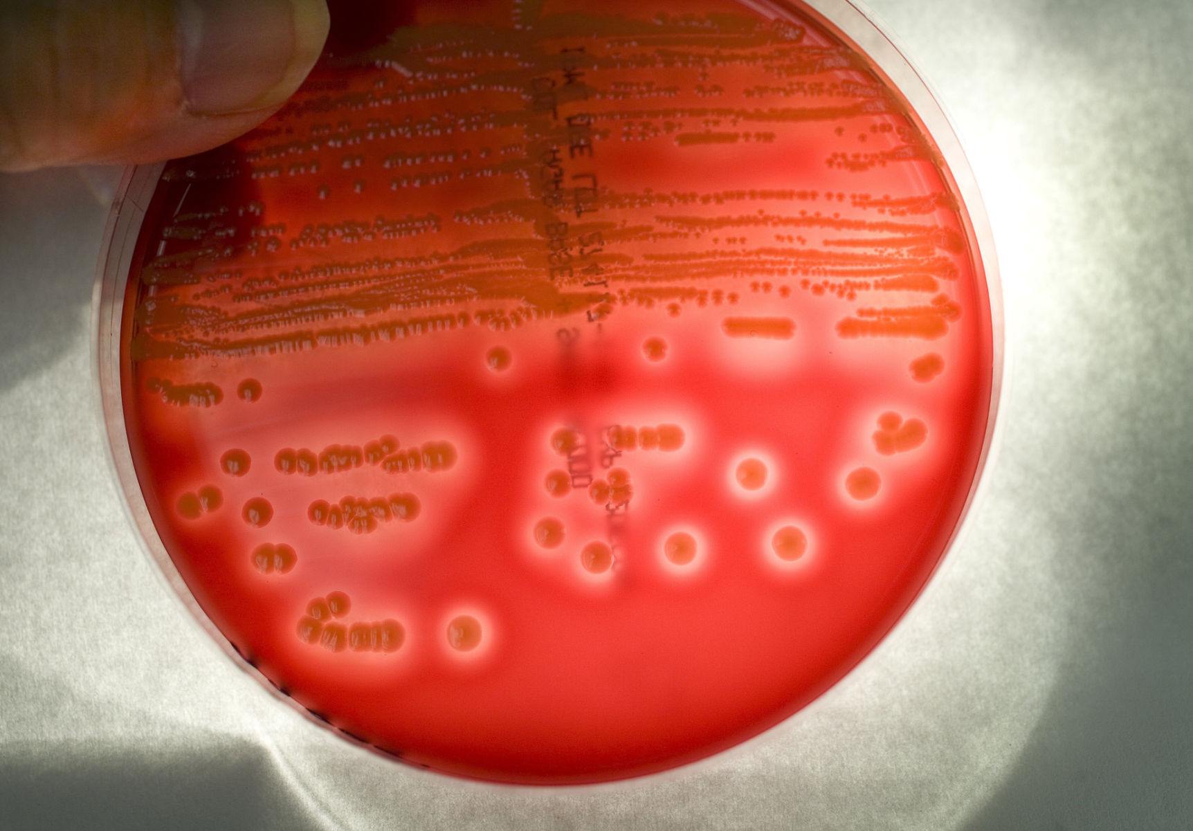 Staphylococcus e coli. Staphylococcus e coli. Стафилококки инфографика. Стрептококки гемофильная палочка. Среда макконки микробиология.