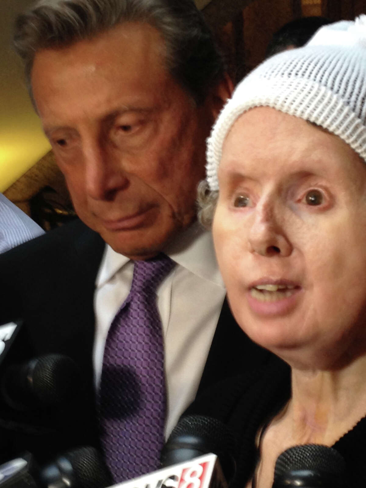 Charla Nash, who required a face transplant following a 2009 chimp attack, attends a legislative hearing Mar. 21, 2014, in Hartford, Conn. where lawmakers were considering a bill that would overturn a state commissioner's ruling that denied Nash the right to sue the state.