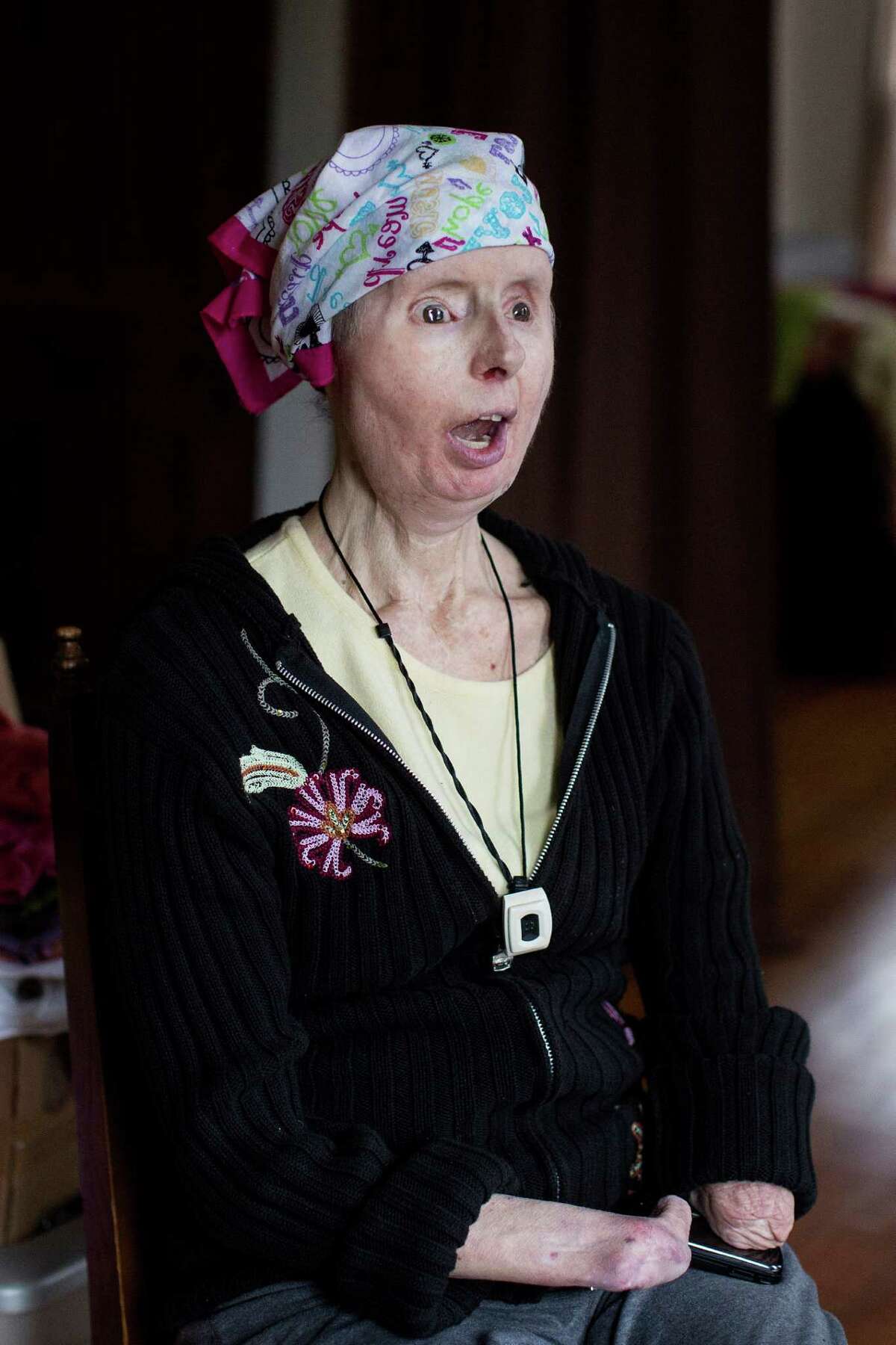 The Face Of Survival: Charla Nash'S Photo Testimony - m1dzu7v
