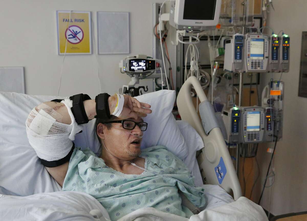 Reginald Cook, 37, wipes his brow with his newly transplanted elbow while recovering in his hospital room at UCSF Medical Center May 13, 2016 in San Francisco, Calif. The motion was something he was incapable of doing himself before the surgery. Cook may be the first person to ever receive an elbow transplant from his own body. A serious car accident rendered his left arm basically useless and his right arm had very limited abilities. Cook asked his doctor if it would be possible to try to transplant his left elbow to his right arm so that he could regain much of the control lost. After months of research and preparation, Cook, who is from Texas, underwent the surgery at UCSF a few weeks ago.