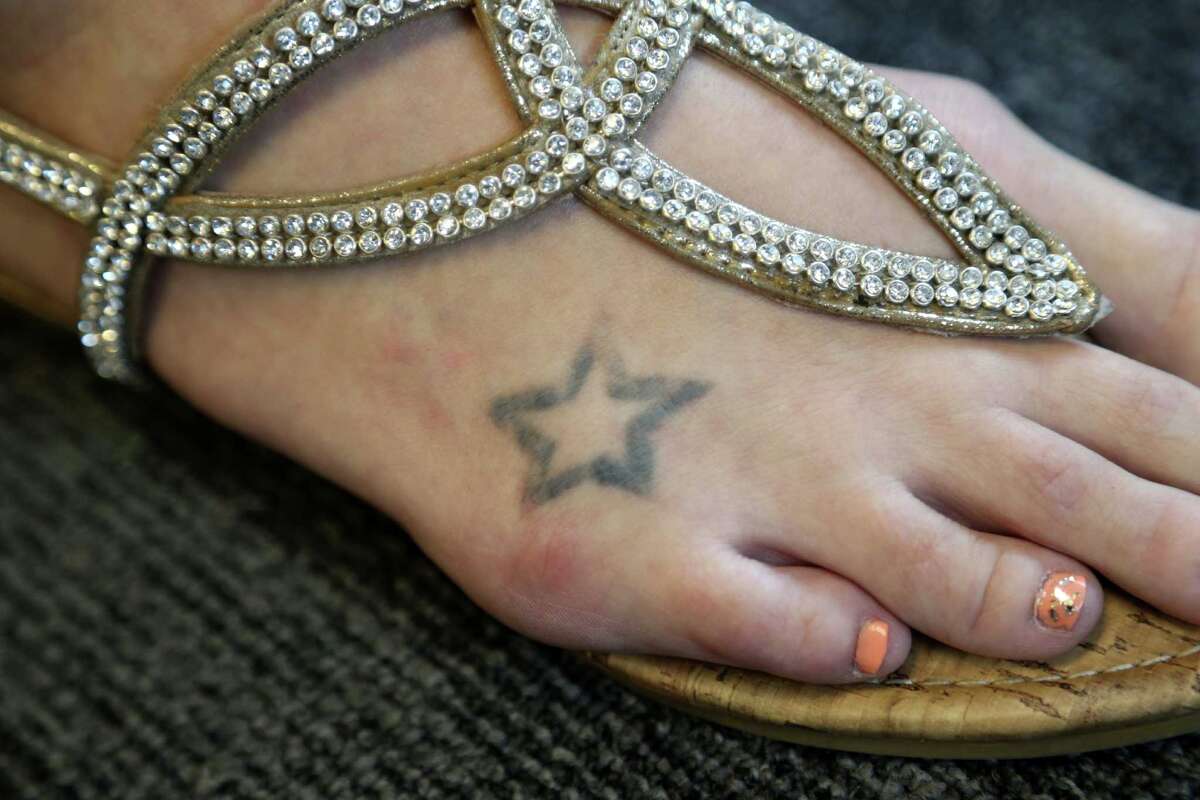 Zap that regret Better laser speeds tattoo removal