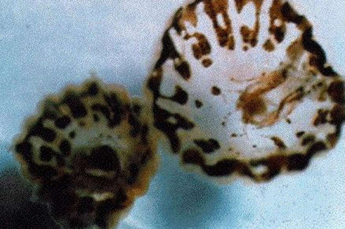 Sea lice, or "sunbather's eruption", is being reported by health officials and the Gulf's beach visitors. Continue clicking to see weird things that have been found on Texas beaches.
