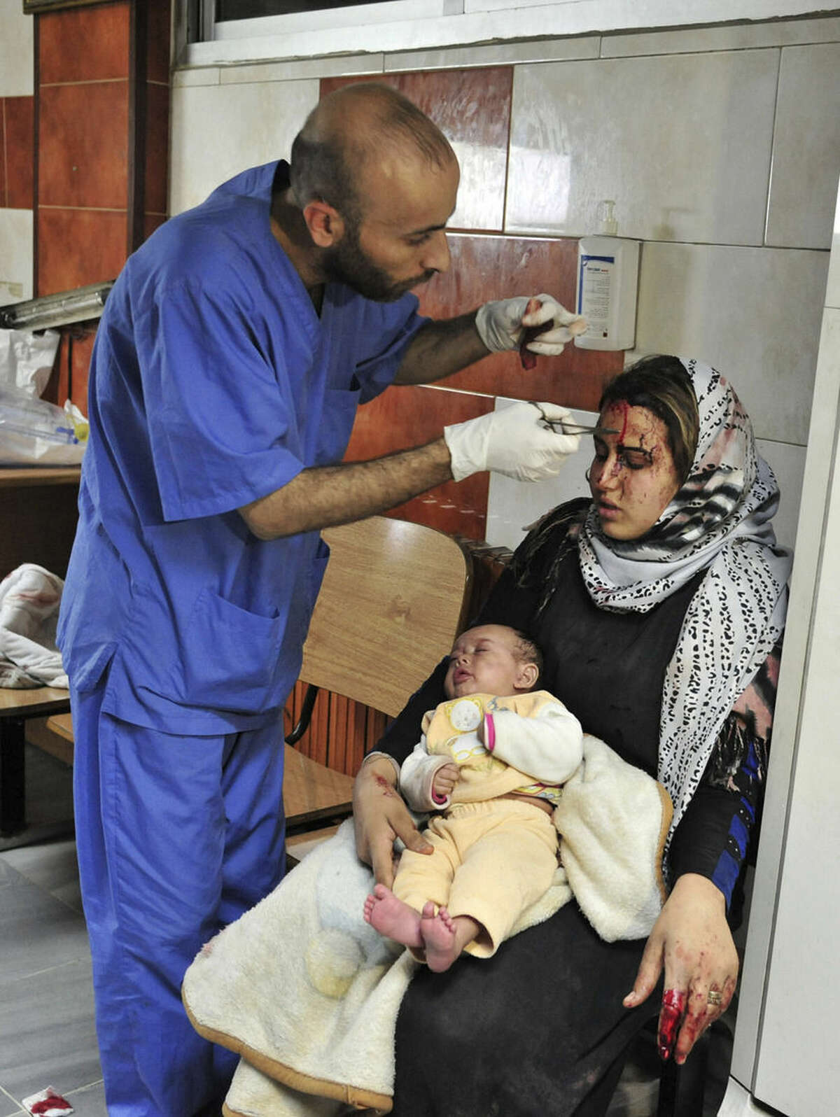 In this photo released by the Syrian official news agency SANA, an injured victim of the triple blast in Sayyida Zeinab, a predominantly Shiite Muslim suburb of the Syrian capital Damascus arrives to a hospital to receive treatment, Syria, Sunday, Feb. 21, 2016. The Islamic State group claimed responsibility for a triple blast in the Shiite suburb, saying two IS fighters set off a car bomb before detonating their explosive belts and killing dozens. (SANA via AP)