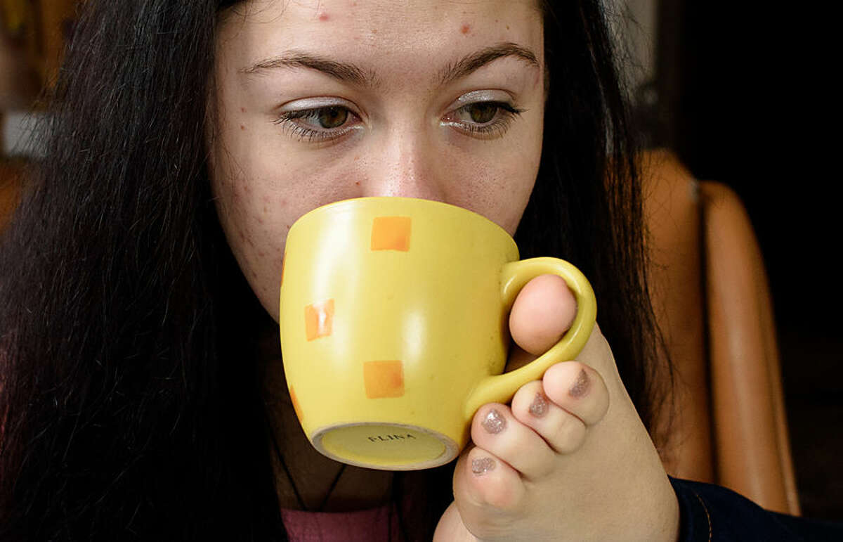 In this photo taken Tuesday, Feb. 10, 2015, Marina Khodiy, 21, drinks tea at her home in the village of Lesnovka, Crimea. Marina learned to draw early in childhood like most children. The only difference was that she had to do it with her toes, since she was born without arms. She also learned to use her feet to work on a computer and even to tap out text messages on her cell phone. With her dexterous feet, she can drink a cup of tea and peel potatoes for dinner. (AP Photo/Alexander Polegenko)