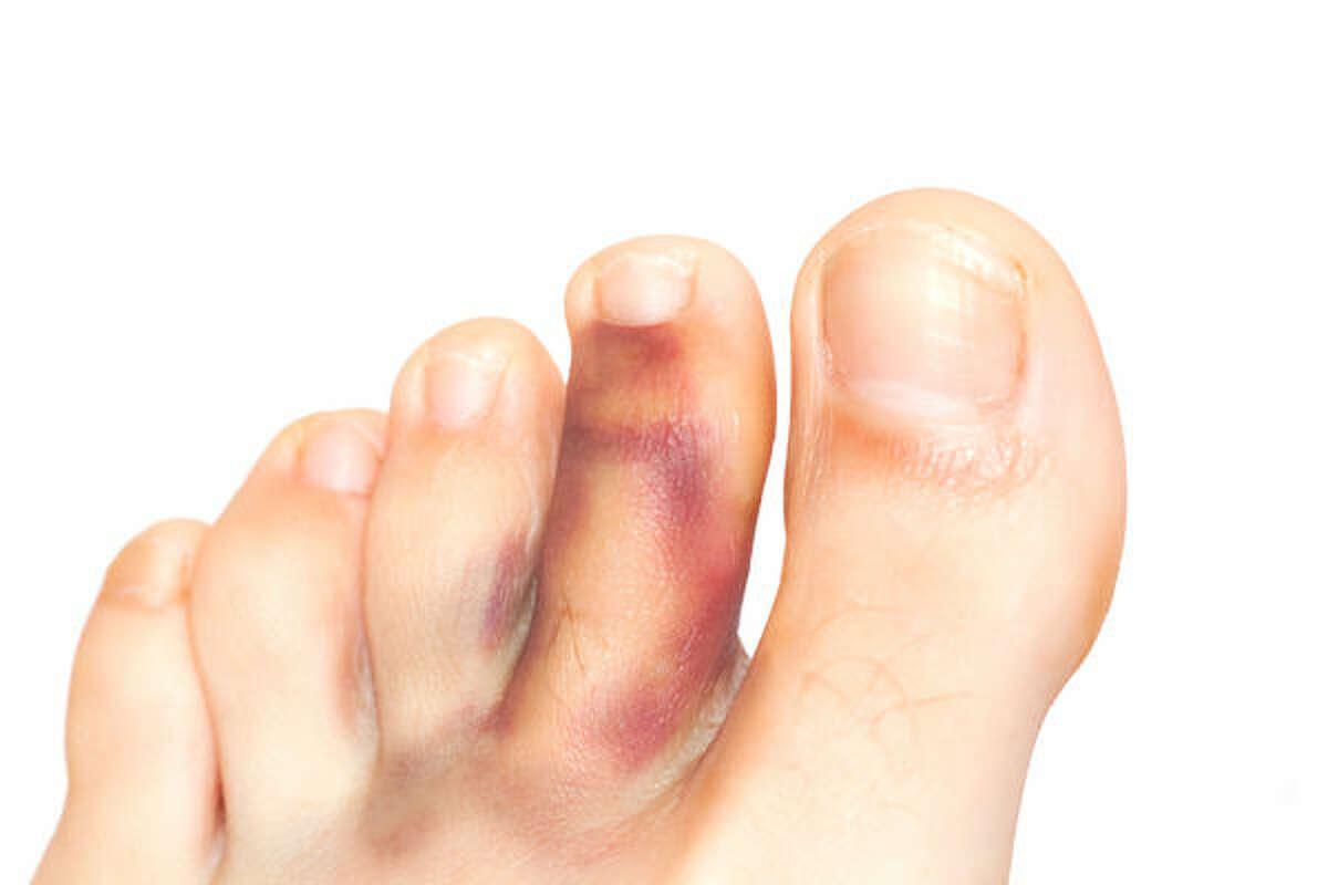 4 Signs Your Foot or Ankle is Overused or Injured