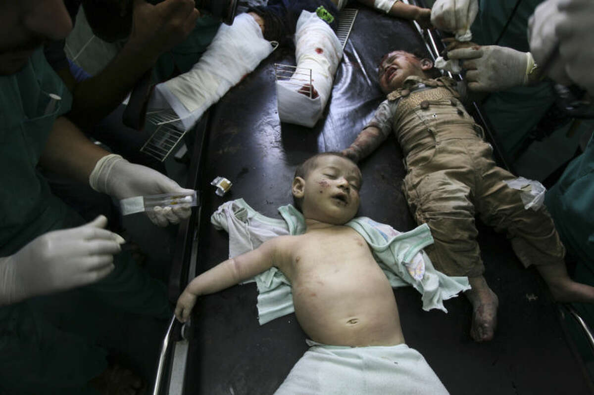 Palestinian children wounded in Israeli shelling are treated in a hospital in Rafah in the southern Gaza Strip, Friday, Aug. 1, 2014. (AP Photo/Eyad Baba)