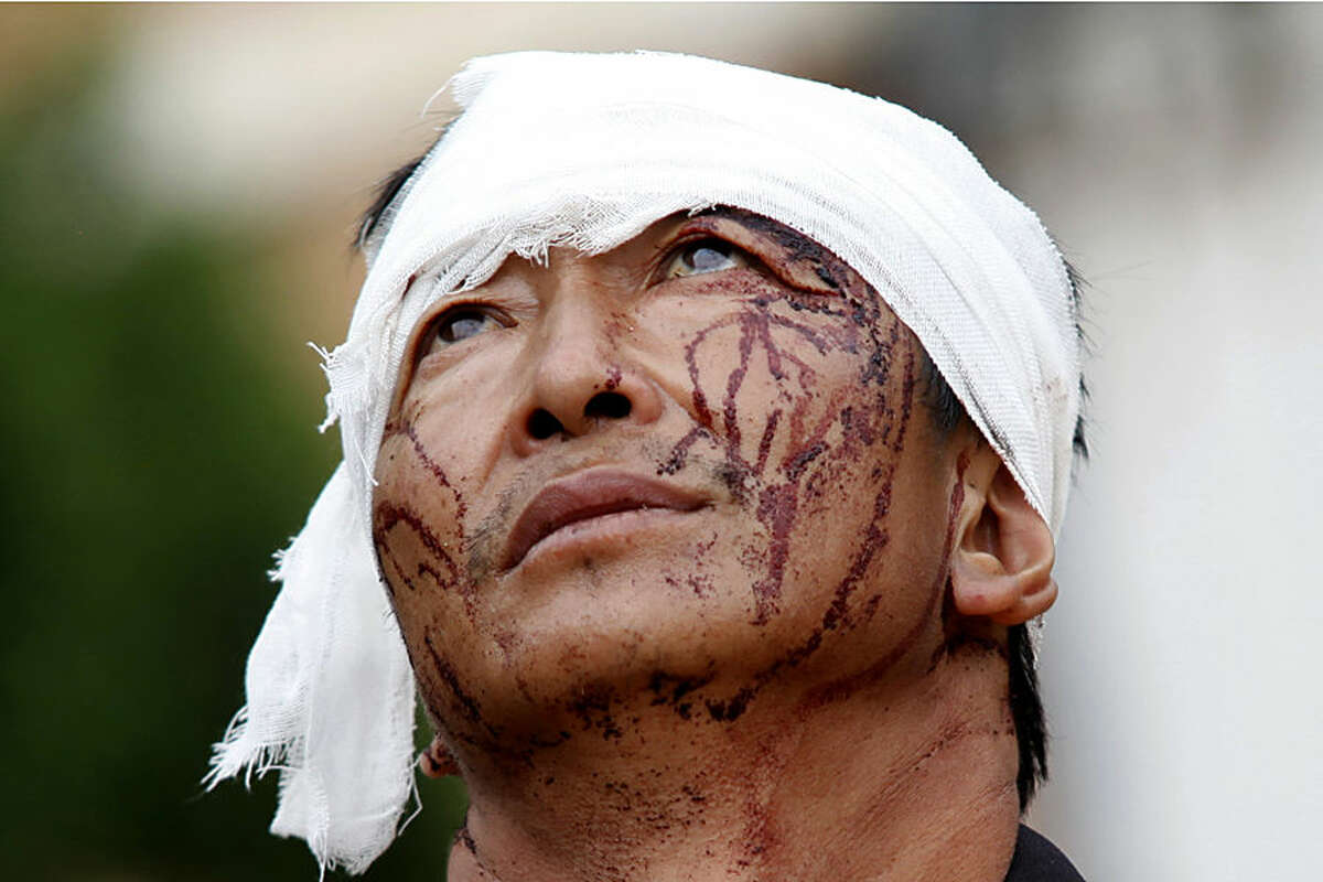 An injured man with dried blood stains on his face stands on the street of the town of Longtoushan which is the epicenter of an earthquake that struck Ludian County in southwest China's Yunnan Province, Monday, Aug. 4, 2014. Rescuers dug through shattered homes Monday looking for survivors of the strong earthquake that toppled thousands of homes on Sunday, killing hundreds and injuring more than a thousand people. (AP Photo) CHINA OUT