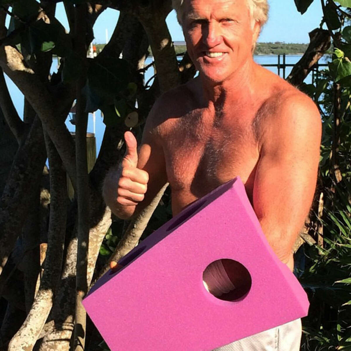 This photo provided by Greg Norman and posted on Instagram on Sunday, Sept. 14, 2014, shows Norman giving the thumbs up with his left hand protected by a purple foam after a chainsaw accident. The Hall of Fame golfer and entrepreneur, was cutting back trees in his South Florida home when the weight of a branch pulled his left hand toward the chain saw. He said the blade hit him just below where a person would be wearing a wrist watch. He said doctors told him it missed his artery by a fraction of an inch. (AP Photo/Courtesy of Greg Norman) NO SALES