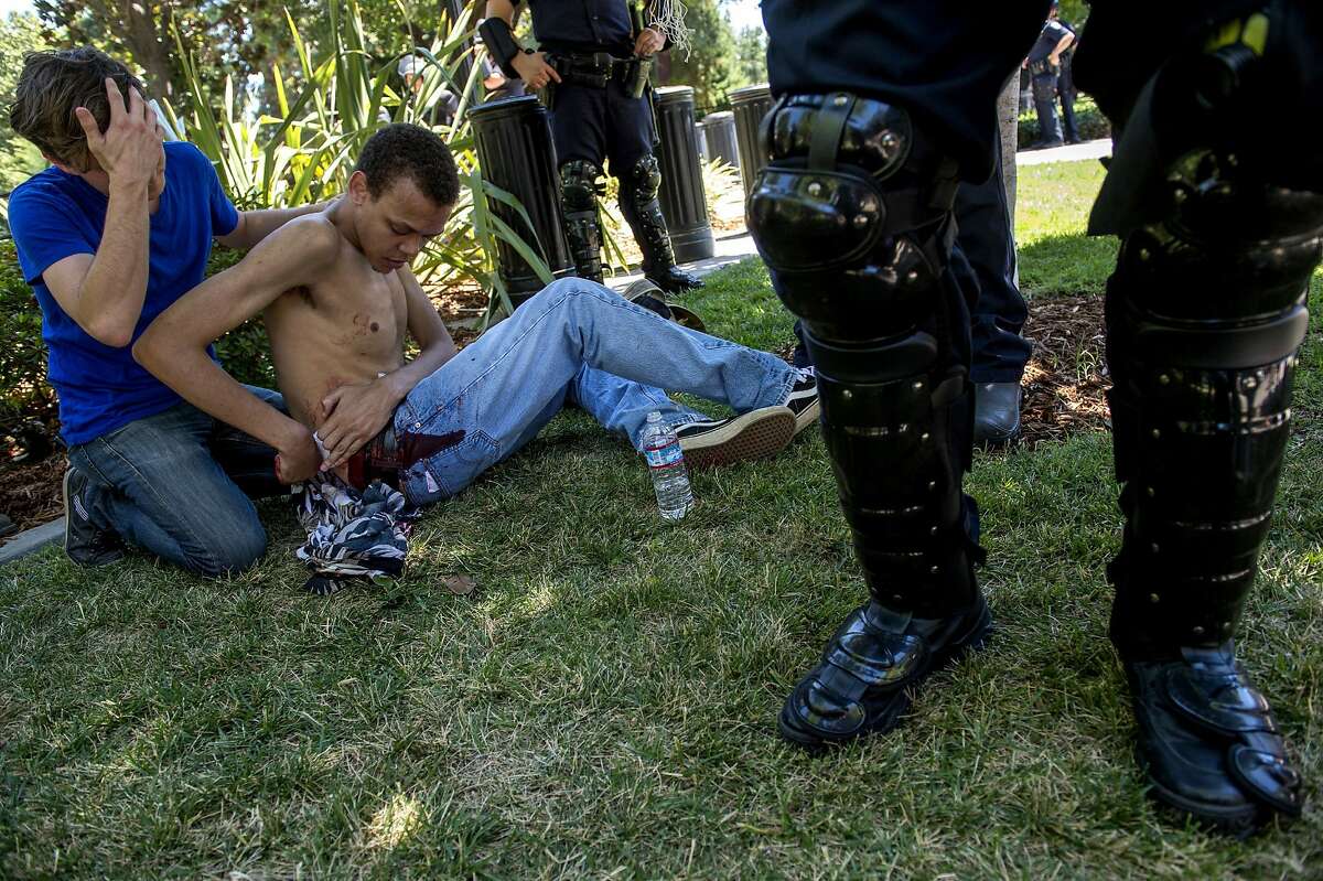 Sean Moore, 23, of Sacramento waits for medics with a friends after being stabbed by protesters at the State Capitol in Sacramento, Calif., on Sunday, June 26, 2016. Sacramento Fire Department spokesman Chris Harvey says a rally by KKK and other right-wing extremists groups turned violent Sunday when they were met by counterprotesters. (Renee C. Byer/The Sacramento Bee via AP) MAGS OUT; LOCAL TELEVISION OUT (KCRA3, KXTV10, KOVR13, KUVS19, KMAZ31, KTXL40); MANDATORY CREDIT