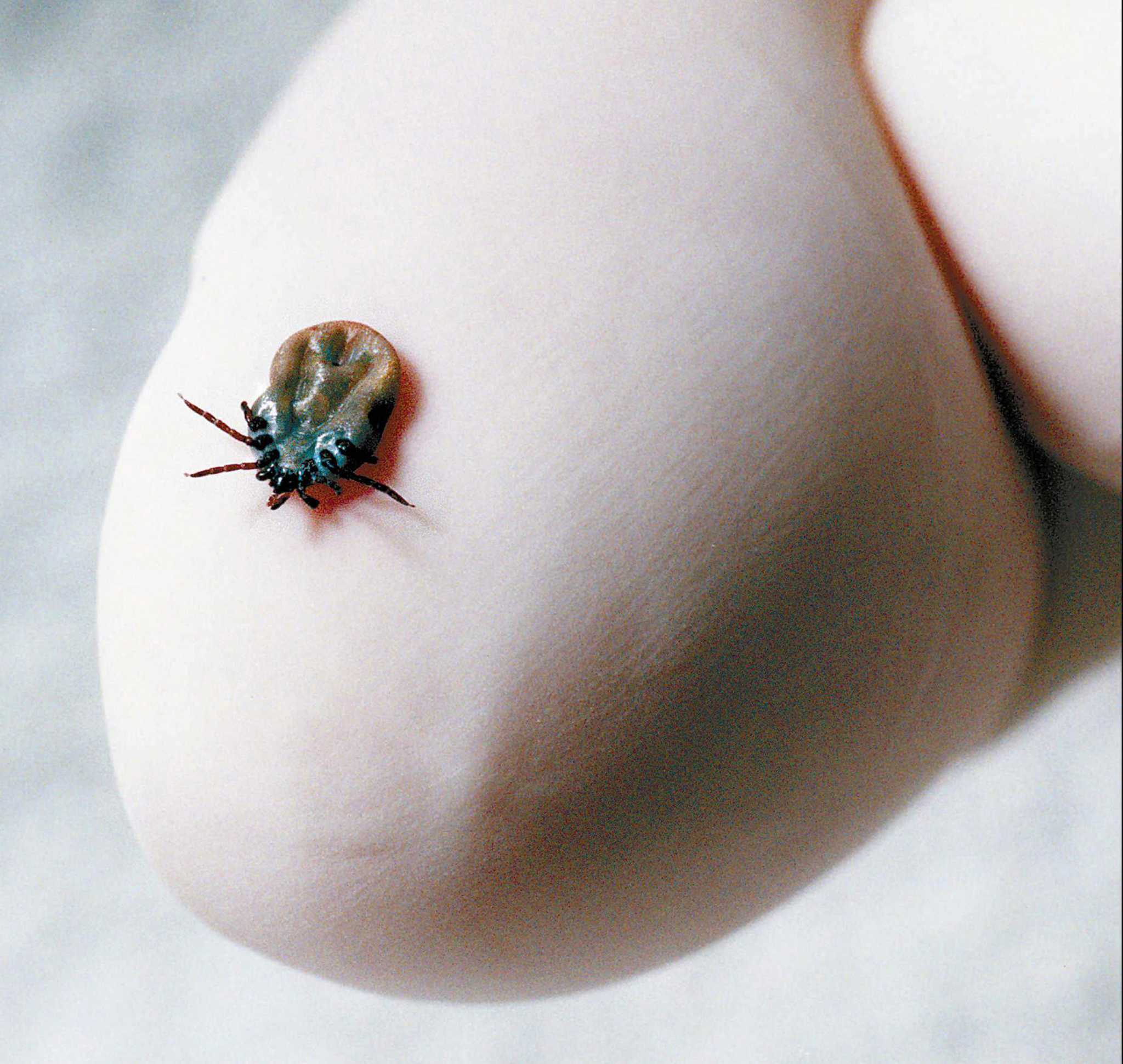Greenwich residents urged to watch out for ticks