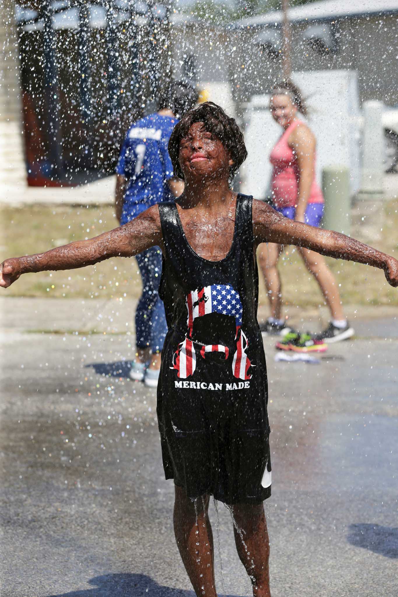 At Burn Camp Scars Don T Matter Expressnews Com