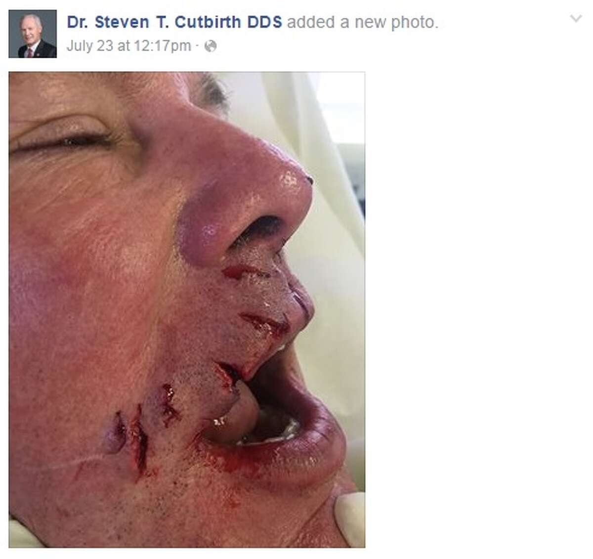 Dr. Steven T. Cutbirth, a Waco dentist, survived a shark attack in the Bahamas and has been sharing his story via Facebook. 