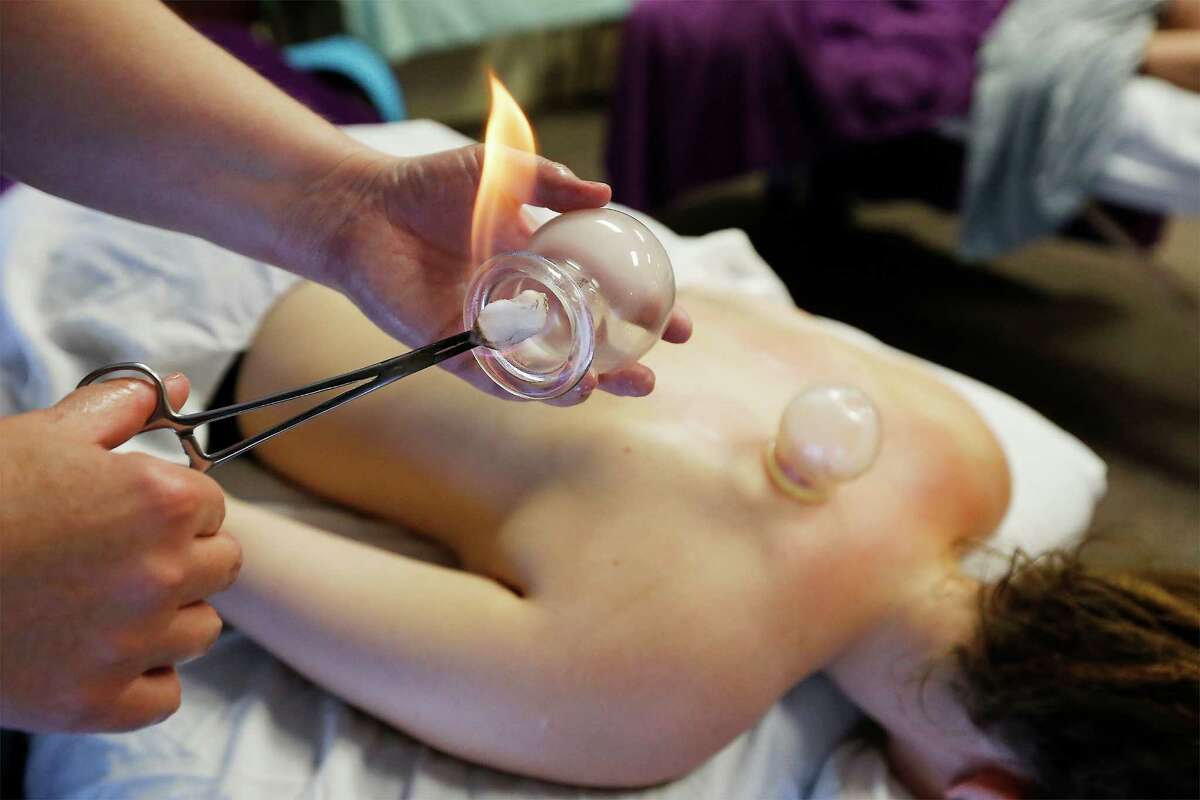 Massage Therapy Instructor Jill Scoggins heats up a glass cup as she demonstrates the therapy practice of cupping at Integrative Healing Institute on Tuesday, Aug. 9, 2016. The facility utilizes different types of cups such as glass cups which uses the heat from a small flame to form the suction (as pictured) or plastic cups which are placed onto the skin and then air is suctioned from within the cup to form the adhesion. Either types of cups provide muscle stress relief and aids the muscles in recovery according to Scoggins. The massage therapist said she has performed cupping on athletes of all levels to helping the elderly. Sessions last from 15-30 minutes and is usually part of a deep tissue massage session, Scoggins said. The price of cupping start at $30 per session.