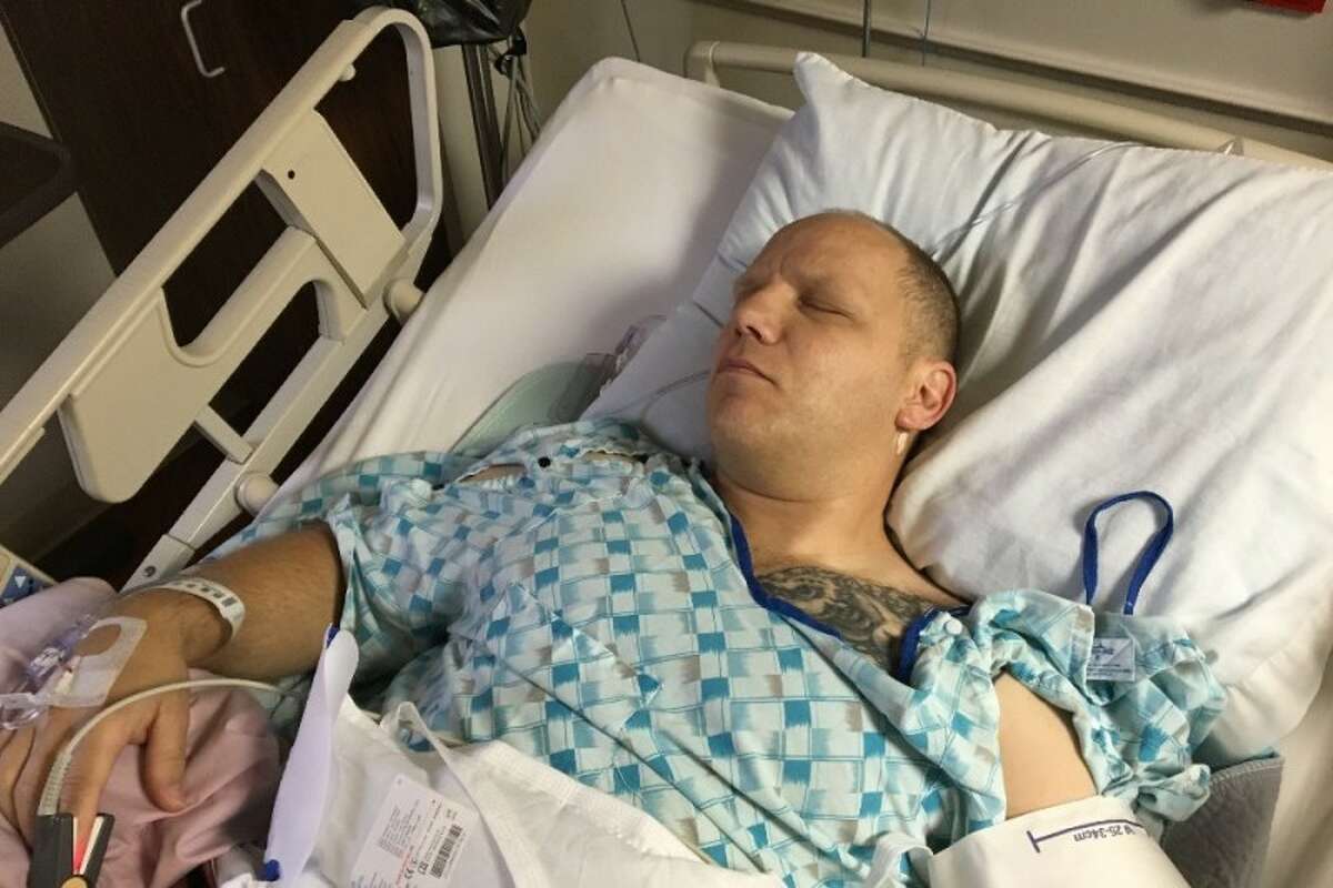 Robert Elrod, a detective for the San Marcos Police Department, is recovering at home after undergoing surgery August 5, 2016 to remove a piece of metal after he accidentally swallowed it.