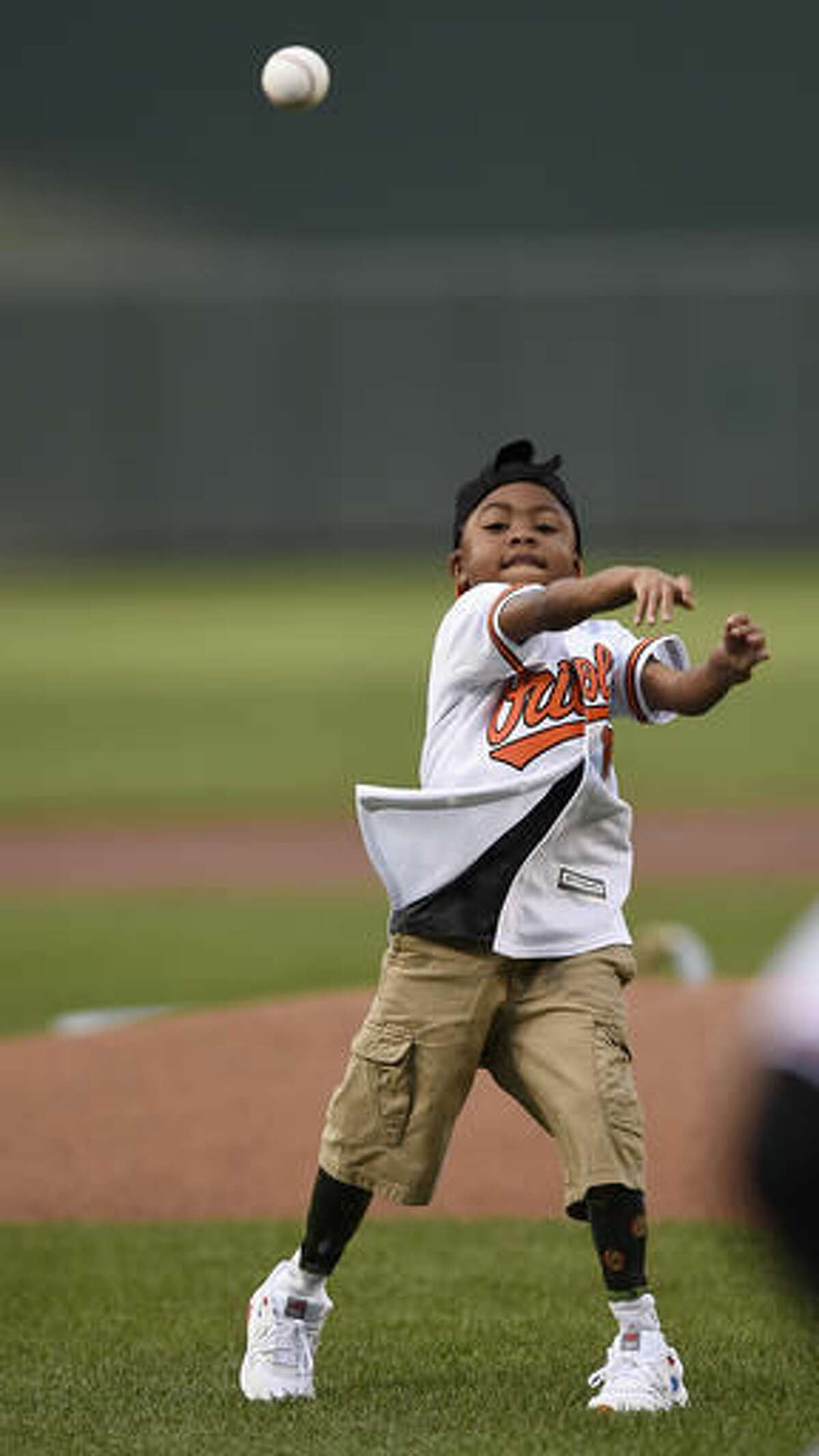 Nine-year-old Zion Harvey, the world's first child to receive a bilateral hand transplant, throws out the first pitch before the Baltimore Orioles and Texas Rangers baseball in Baltimore, Tuesday, Aug. 2, 2016. Harvey, who lost his hands and feet to a serious infection has become the youngest patient to receive a double-hand transplant, surgeons said Tuesday. (AP Photo/Gail Burton)