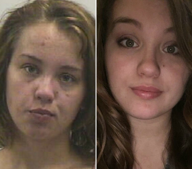 24 Year Old S Photo Of Before And After Heroin Use Goes Viral On Reddit