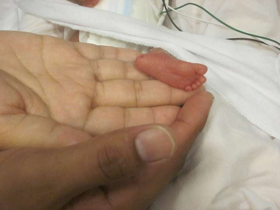 micro preemies
